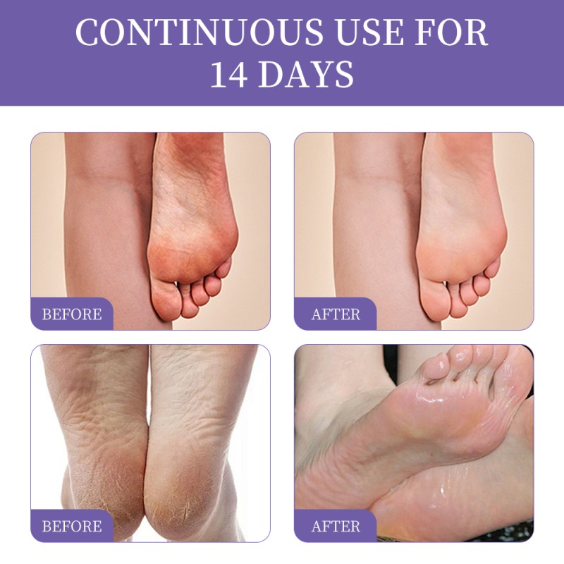 Foot Mask Supplier - Organic Lavender Exfoliating Whitening Callus Removal Moisturizing