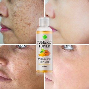 Toner Spray Manufacturer - Organic Turmeric Vegan Hyaluronic Acid Ginseng Dark Spot