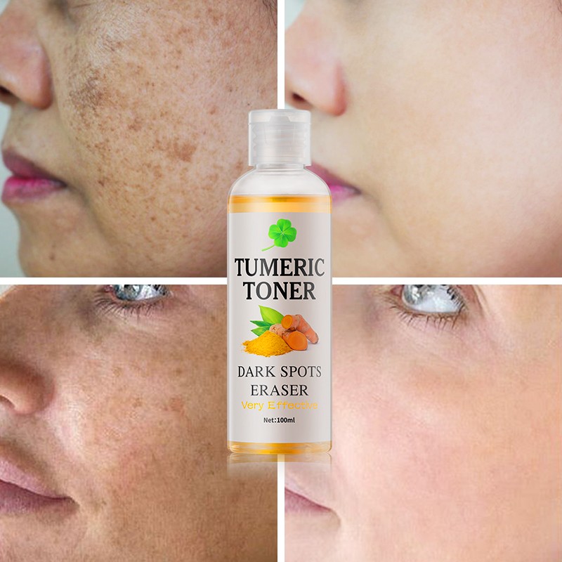 Toner Spray Manufacturer - Organic Turmeric Vegan Hyaluronic Acid Ginseng Dark Spot