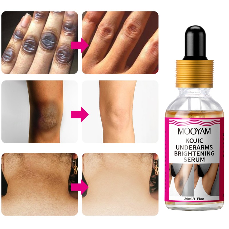 Underarm Serum Supplier - Pure 30ml Kojic Acid Moisturizer Face Anti-Wrinkle Anti-Aging
