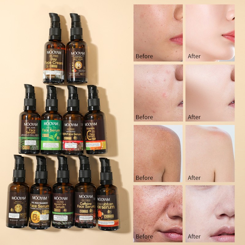 Niacinamide Serum Manufacturer - Retinol Wrinkle Removal Skin Brightening Firming