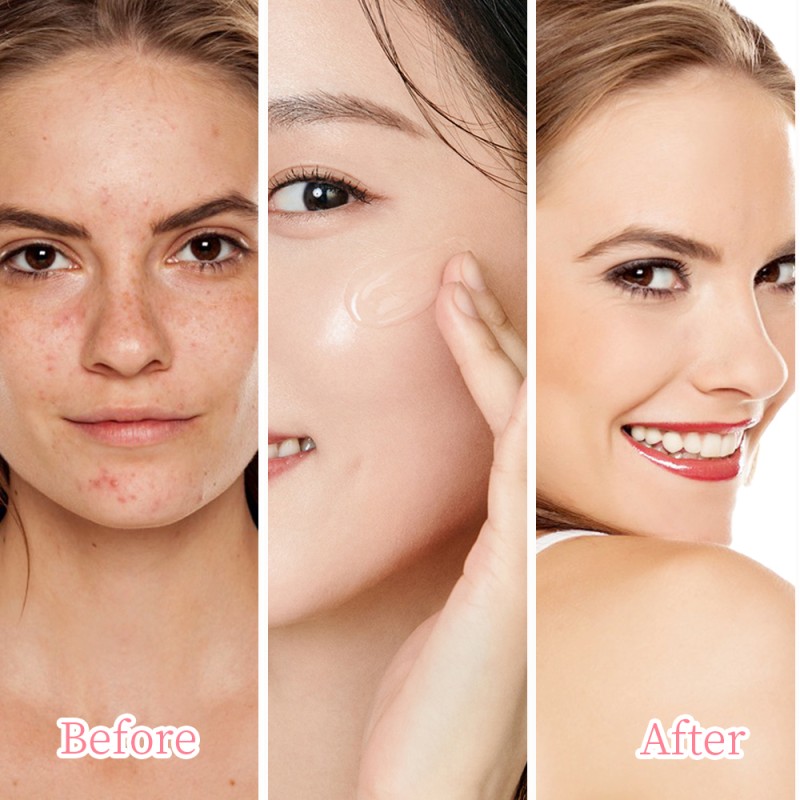 Facial Toner Supplier - MOOYAM 120ml Organic Herbal Hyaluronic Acid Niacinamide VC