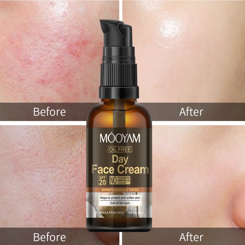 Anti-Aging Serum Supplier - Niacinamide Green Tea Vitamin C Retinol Acne-Prone Skin