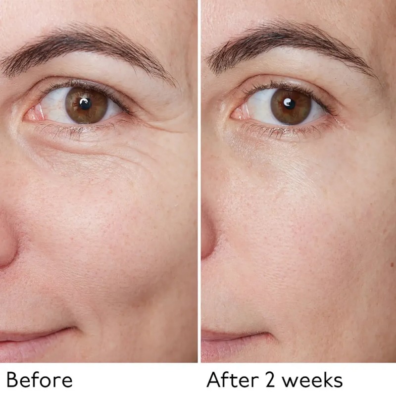 Eye Patches Supplier - 24K Anti-Aging Retinol Rose Crystal Sheet Brightening