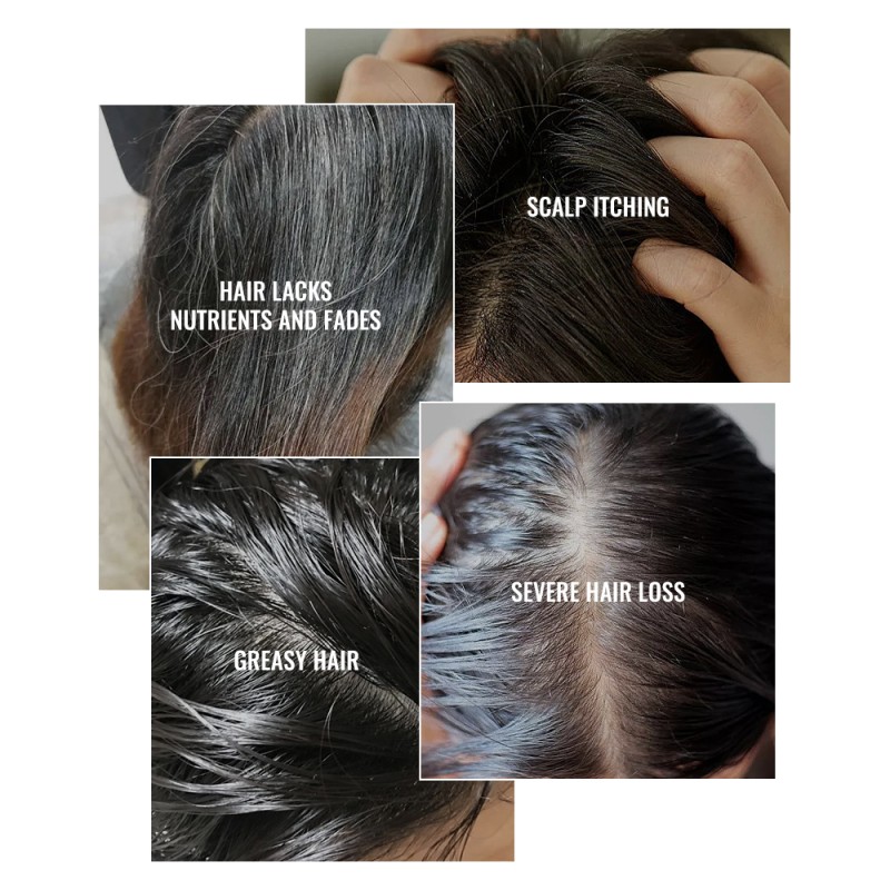 Shampoo Manufacturer - 500ml Vegan Tea Tree Scalp Relief Dandruff Prevention Hair