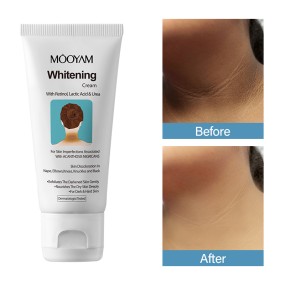 Whitening Cream Factory - Organic for Acanthosis Nigricans Glycerin Niacinamide Based