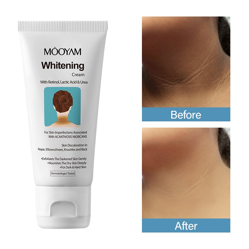 Whitening Cream Factory - Organic for Acanthosis Nigricans Glycerin Niacinamide Based