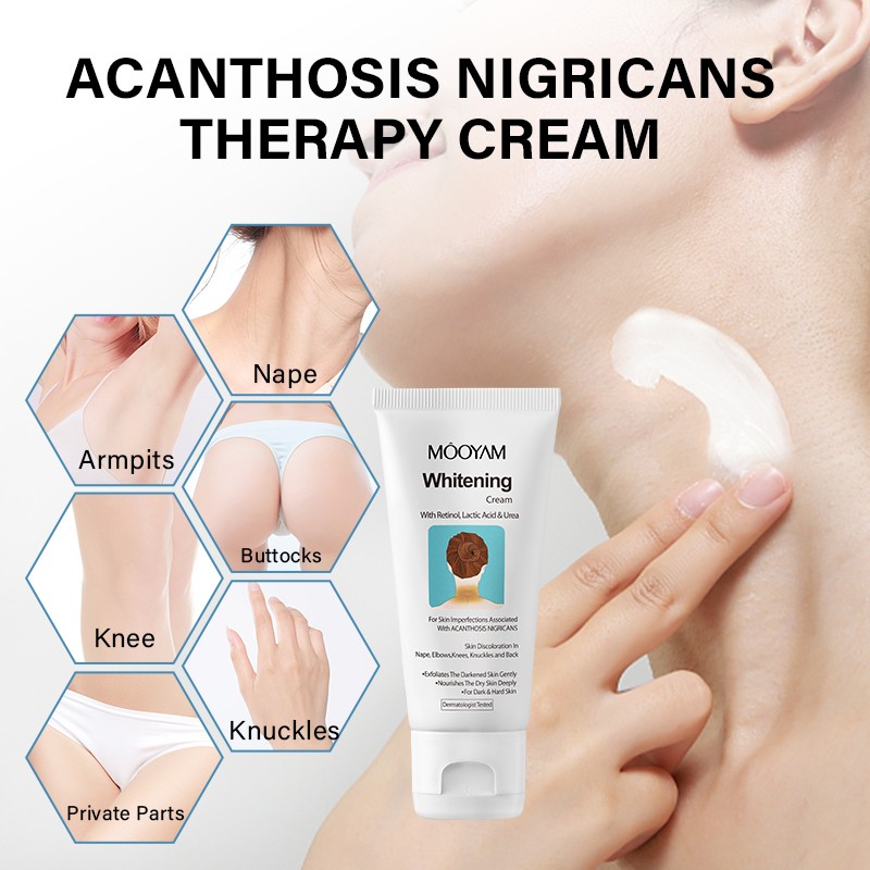Whitening Cream Factory - Organic for Acanthosis Nigricans Glycerin Niacinamide Based