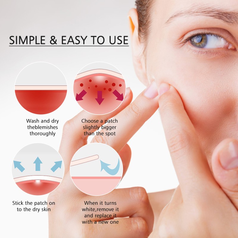 Pimple Patches Supplier - Custom Hydrocolloid Night Covering Zits Acne Invisible