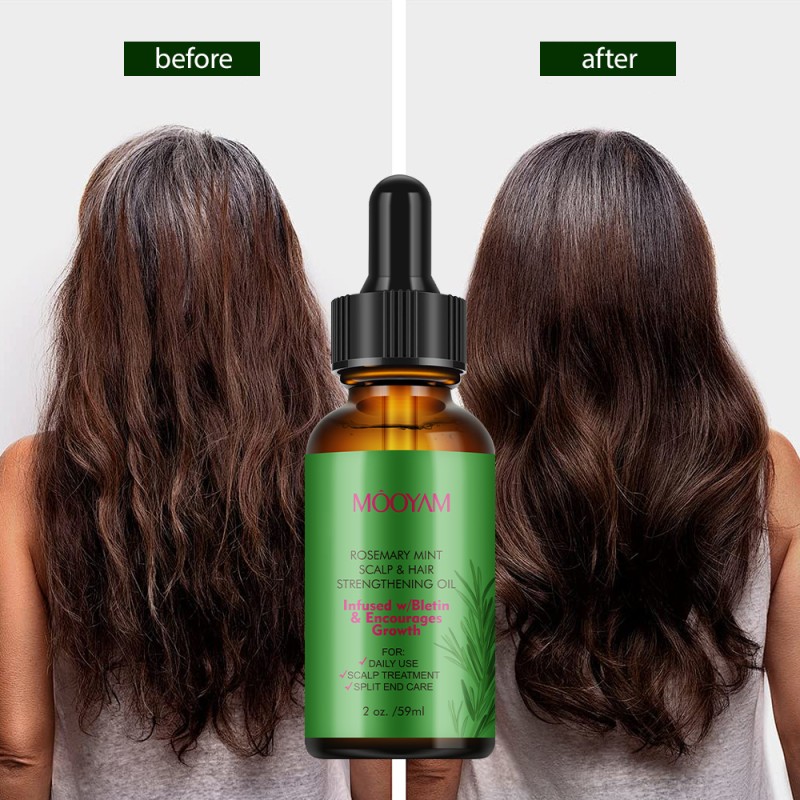 Hair Growth Oil Factory - Private Label Vegan Biotin Rosemary Essential Oils Moisturizing