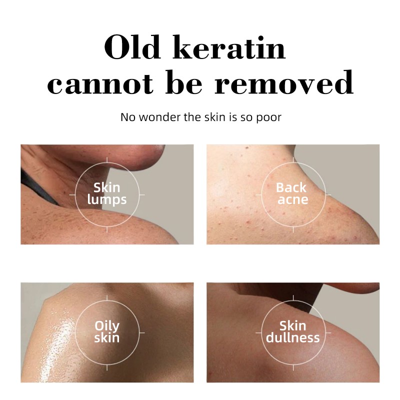 Body Scrub Factory - Organic Aloe Vera Tea Tree White Tea Salt Gel Moisturizing