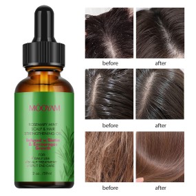 Hair Growth Oil Factory - Private Label Vegan Biotin Rosemary Essential Oils Moisturizing