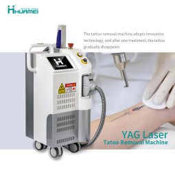Nd Yag Laser Factory - OEM Q Switch Carbon Peel Removal Black Nevus Machine