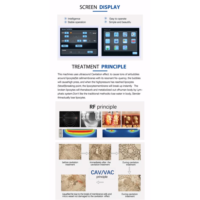 Vacuum RF Equipment Supplier - Therapy Vacuum Rf 40 28 khz Laser Portable Cavislim Lipolysis