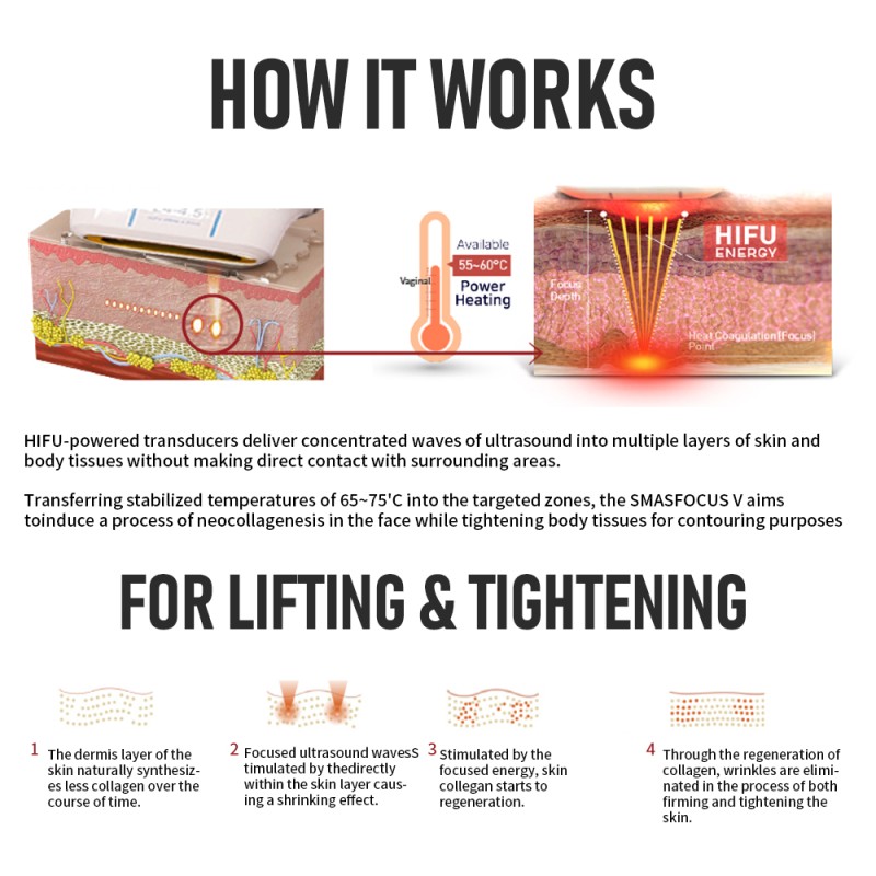 HIFU Machine Supplier - Portable CE New Face Lift Skin Tightening Vaginal Tightening 9d Ultrasound