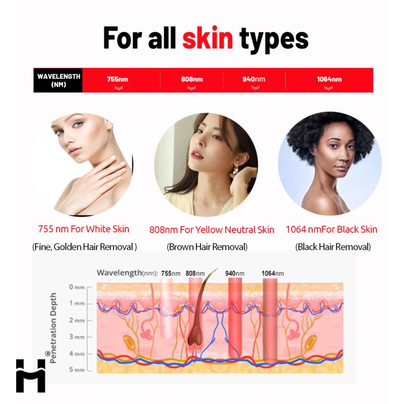 Diode Laser Hair Removal Machine Manufacturer - OEM ODM 755 808 940 1064nm Ice Cooling