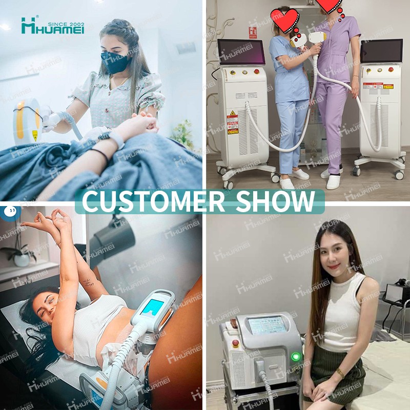 Nd Yag Laser Supplier - CE Q Switch Long Pulse Lazer Tattoo Removal 1064nm 532nm