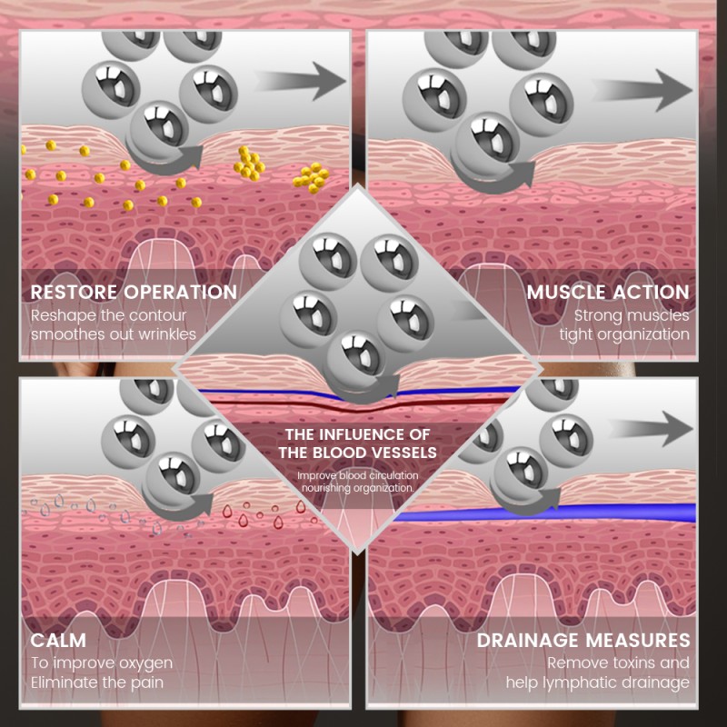 Inner Ball Roller Supplier - Cellulite Reduction Lymphatic Drainage Rollsculpt Slimming Massage