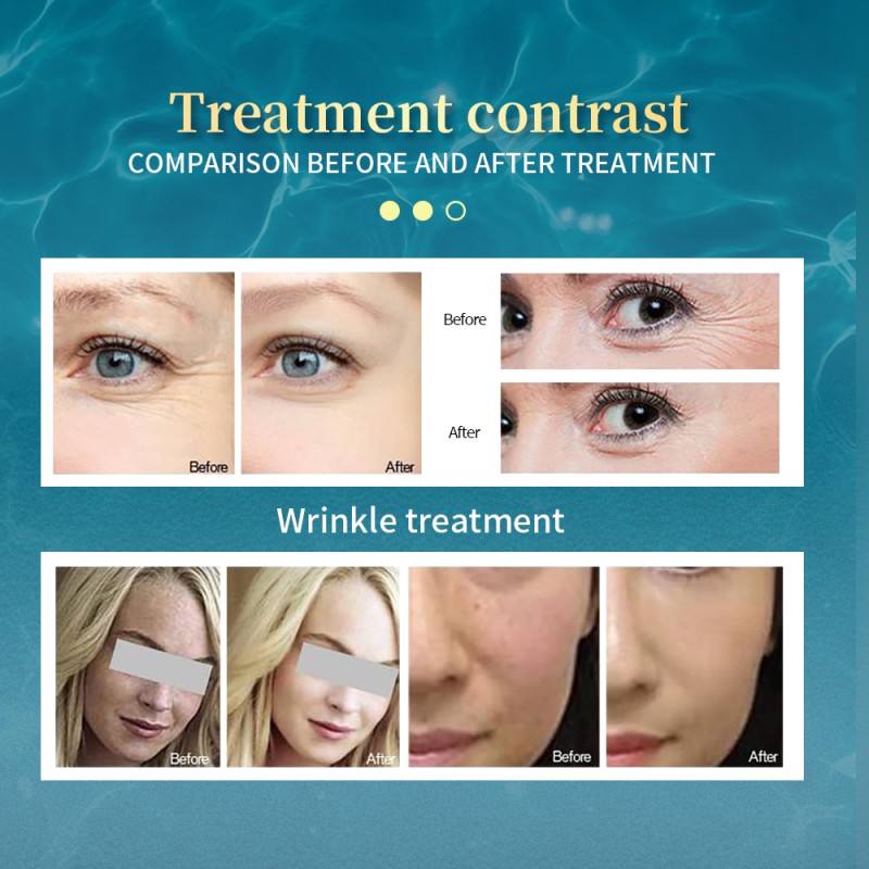 HIFU Machine Manufacturer - Professional Facial Neck Tightening New Anti-Wrinkle 7d Vaginal Tighten