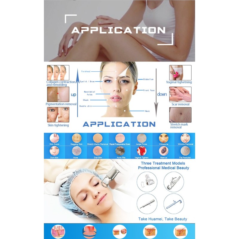 CO2 Laser Machine Factory - 2025 Newest Female Private Therapy Vagina Tightening Portable