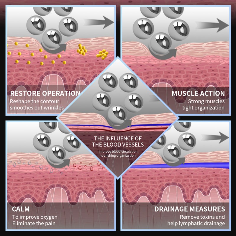 Inner Ball Roller Factory - 9d Vacuum Slimming Inner Ball Roller Massage Machine