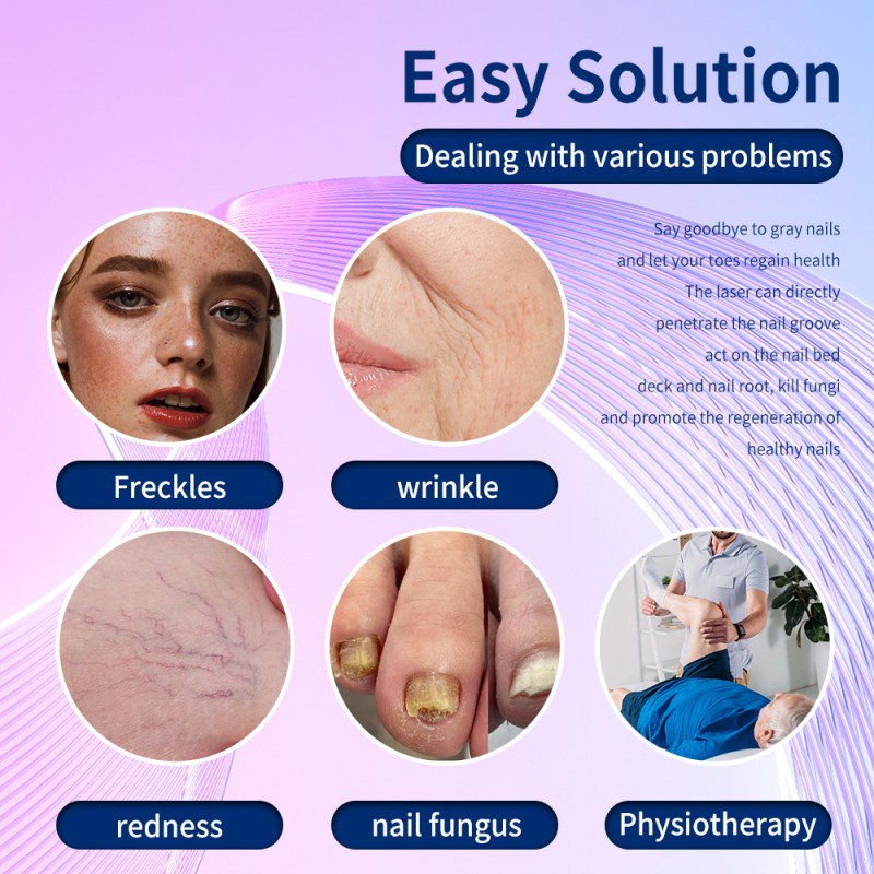 Diode Laser Manufacturer - 980nm Vascular Removal Nail Fungus Removal Laser Vascular Spider Veins