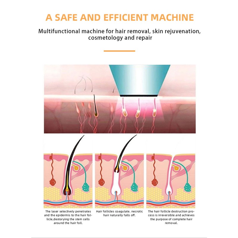 IPL Machine Manufacturer - Medical Aesthetic Equipment Opt Skin Rejuvenation Wrinkle Removal