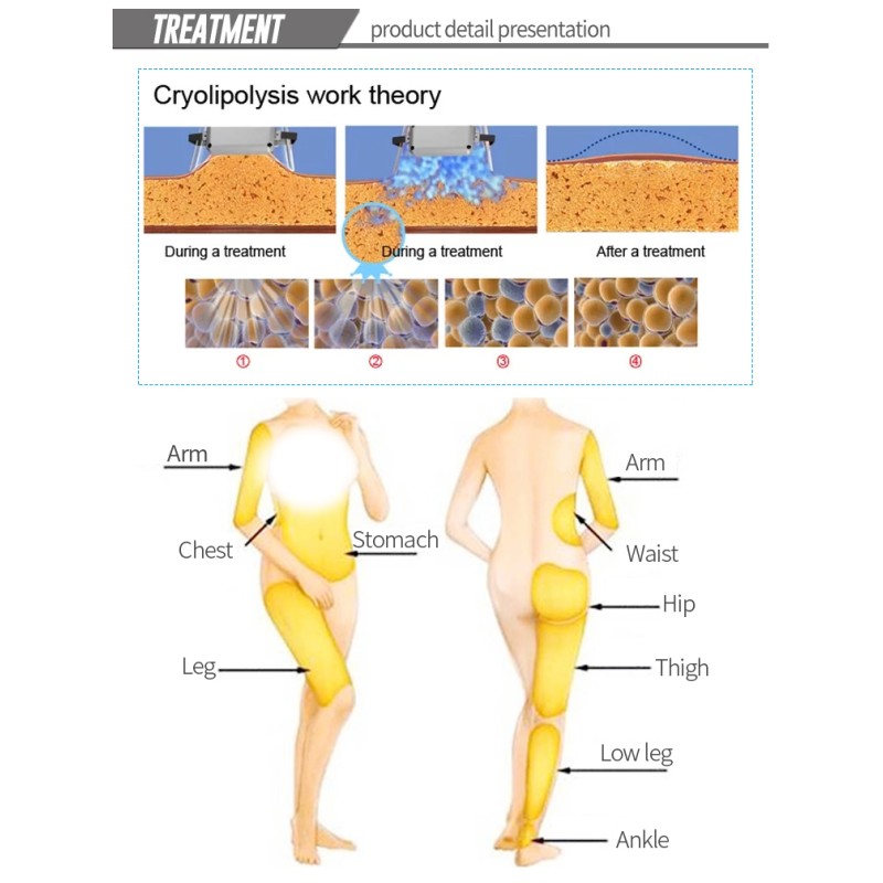 Cryo Slimming Manufacturer - Weight Loss Beauty 4 Handle Fat Freeze Slimming Machine