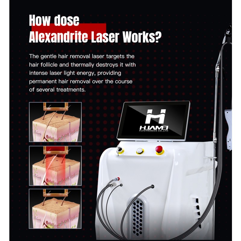 Laser Hair Removal Manufacturer - Big Power 1064nm Gentle Alex Nd Yag 755nm