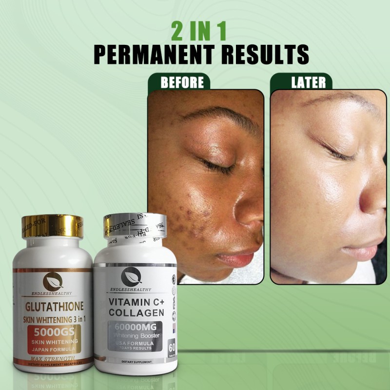 Glutathione Capsule Manufacturer - Top Quality Beauty Products Hot Selling 1000mg