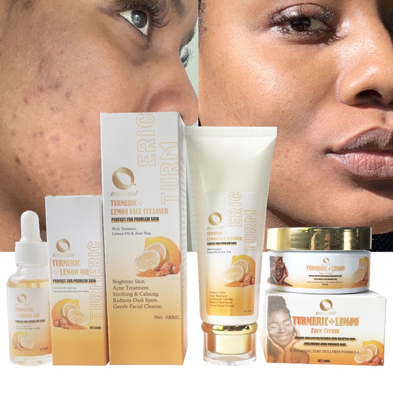 Skin Care Set Manufacturer - Turmeric Brightening Skin Set Acne Spot Removal Facial Cleaning