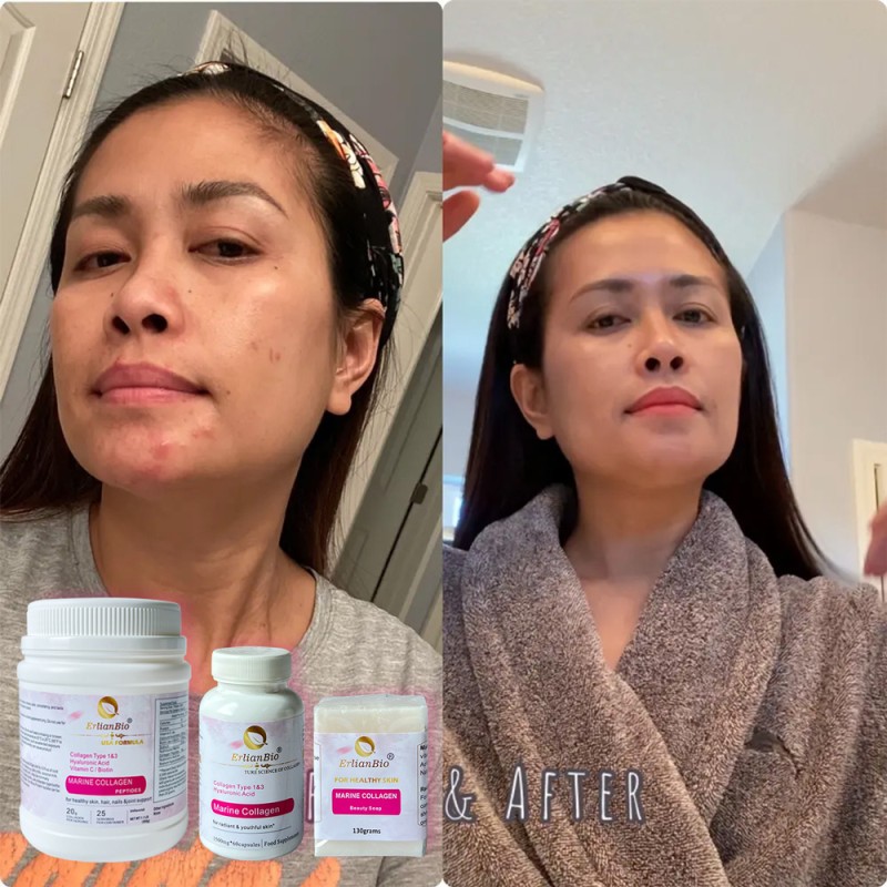 Collagen Capsules Supplier - OME Supplement Marine Fish Skin Hydrolysed Pure Marine Bio