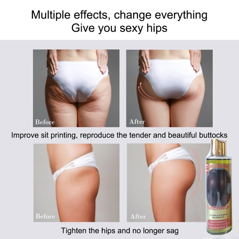 Butt Enlargement Set Manufacturer - Oem/Odm Aguaje Ultimate Maca Buttocks Hip Enlargement Oil