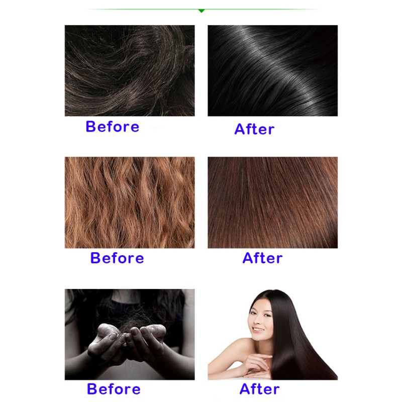 Hair Care Set Manufacturer - Private Label Herbal Nourishing Anti-Loss Ginger Shampoo Conditioner