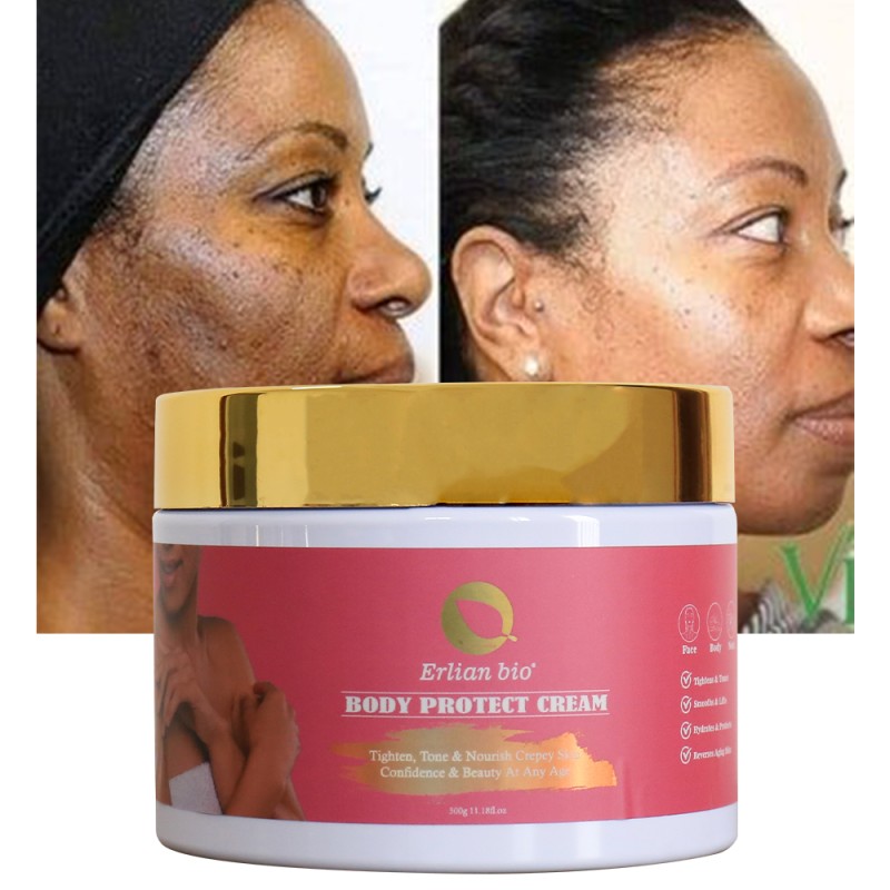 Whitening Cream Manufacturer - Best Product Body Protection Effectively Removing Black Spots