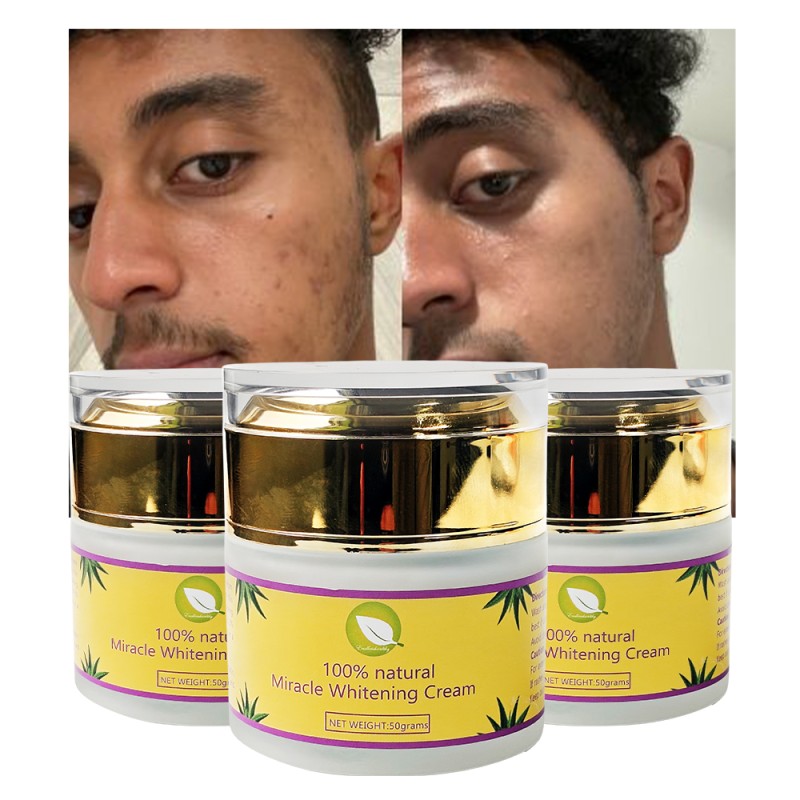 Whitening Cream Manufacturer - OEM ODM Private Label 100% Pure Natural Vitamin C Miracle Brightening