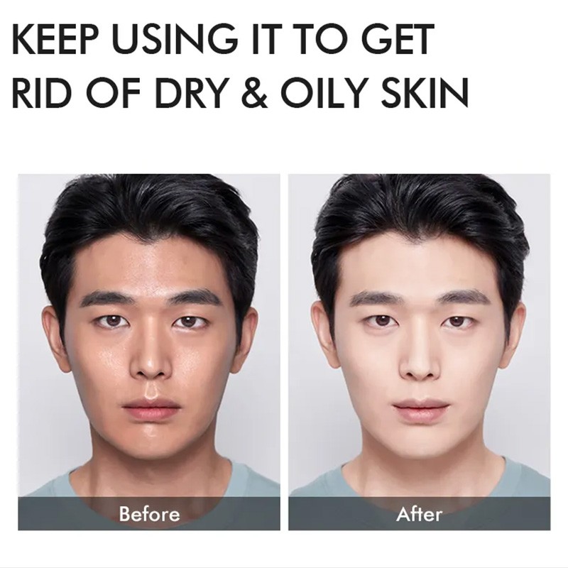Mens Skin Care Products Manufacturer - OEM Korean Cosmetics Men Personal Care Acne Anti Aging
