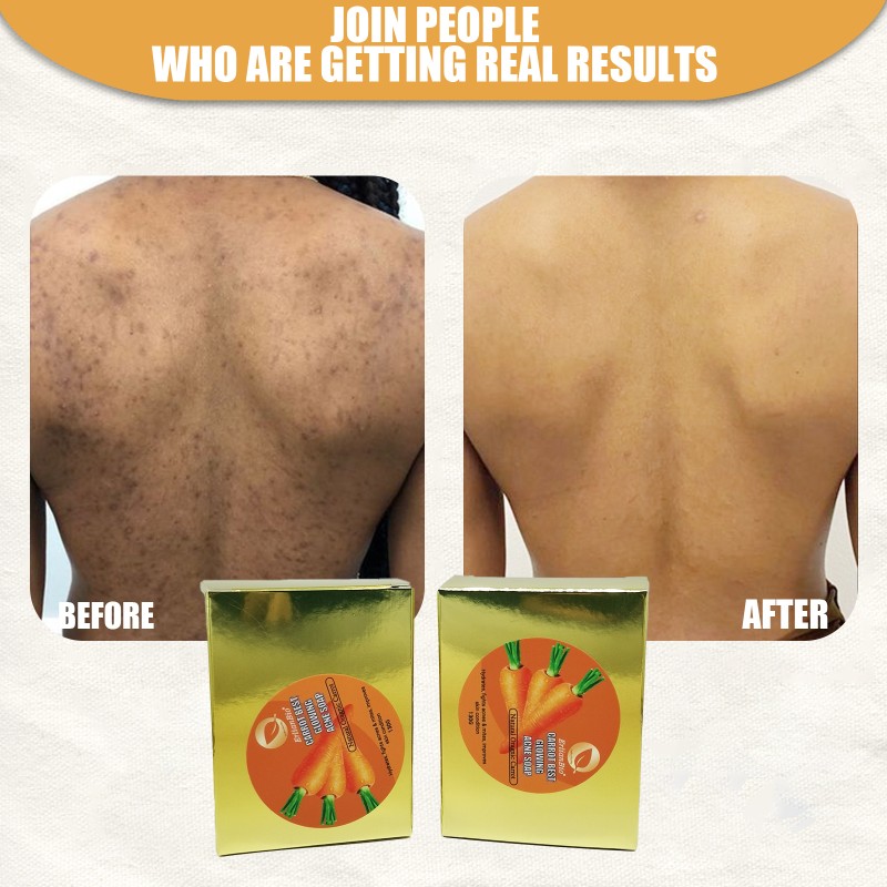 Whitening Soap Factory - High Quality Herbal Deep Cleansing Anti-Acne Properties