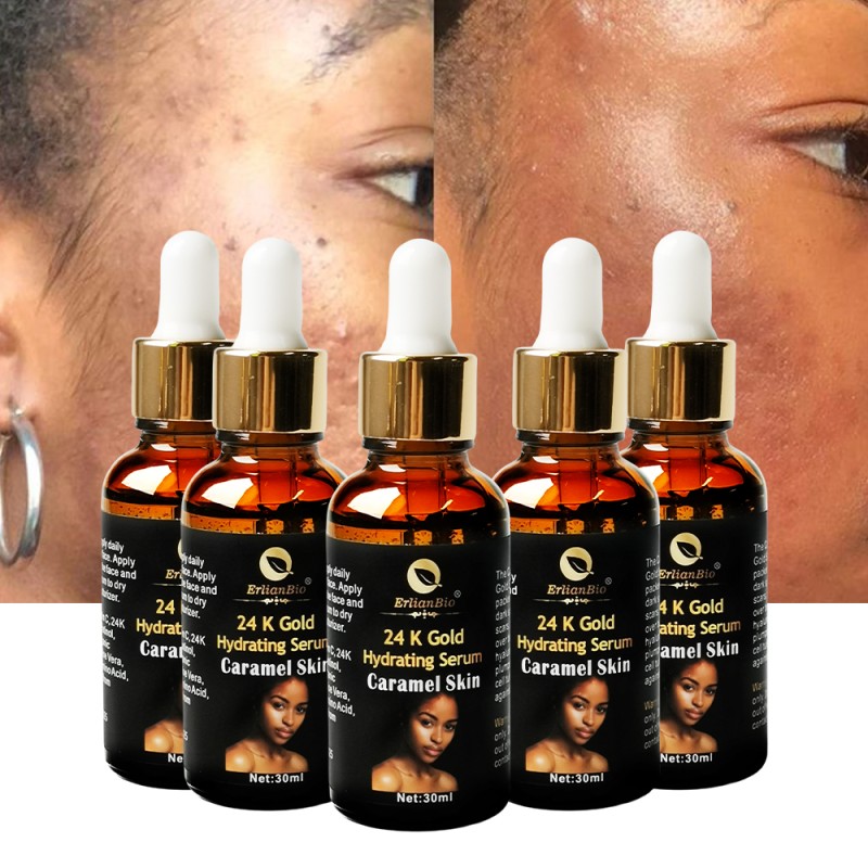 Face Serum Manufacturer - Hot Sale Vitamin E Hyaluronic Acid Vitamin C Brightening