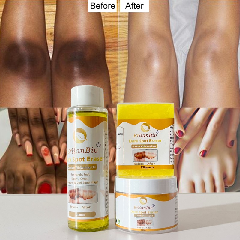 Whitening Cream Manufacturer - Private Label Dark Knees Knuckles Elbows Armpit Whitening Serum
