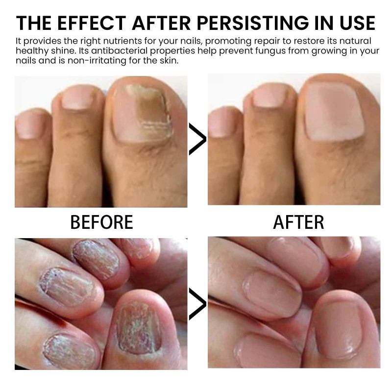 Nail Oil Manufacturer - Organic Nail Oil Cuticle Shine Nail Nutrition Strengthening Tea Tree Oil