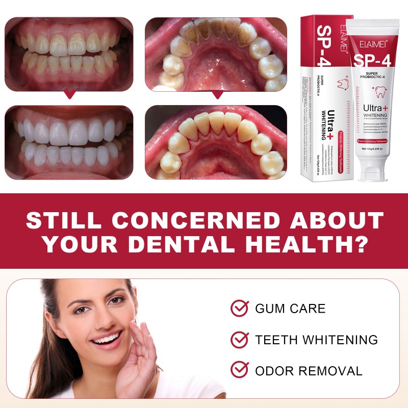 Toothpaste Manufacturer - Oral Care Whitening Toothpaste Protect Gums Fresh Breath Probiotic Toothpaste