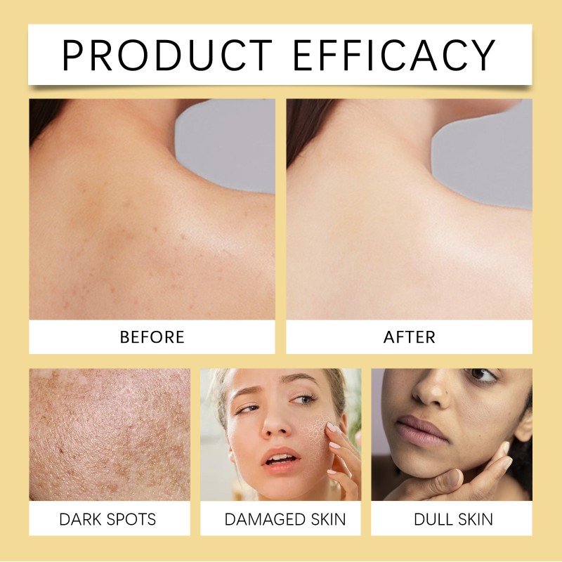 Whitening Oil Supplier - Natural Essential Oil Whitening Nourish Brighten Skin Tone Turmeric Oil