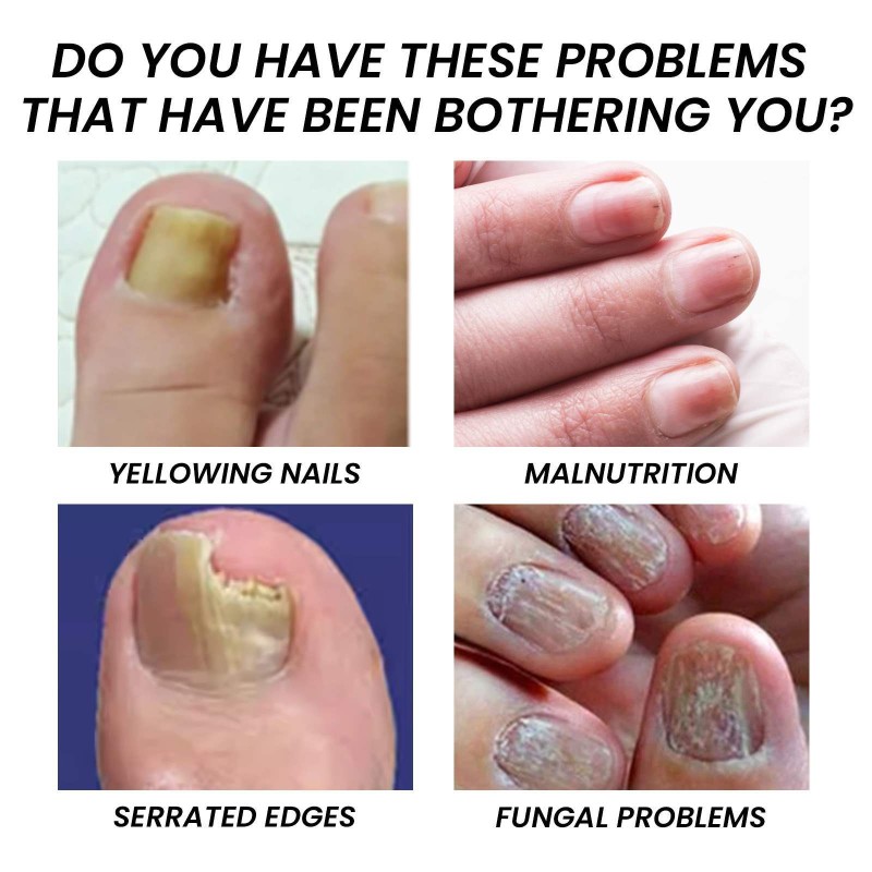 Nail Oil Manufacturer - Organic Nail Oil Cuticle Shine Nail Nutrition Strengthening Tea Tree Oil