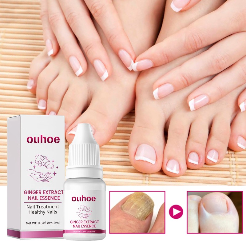 Nail Serum Supplier - Nail Treatment Fungal Nail Repair Rough Promote Growth Ginger Liquid Serum