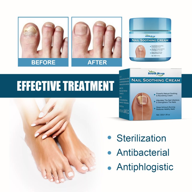 Nail Cream Manufacturer - Natural Nails Nourish Strengthening Cream Anti-fungal Restore Healthy Cream