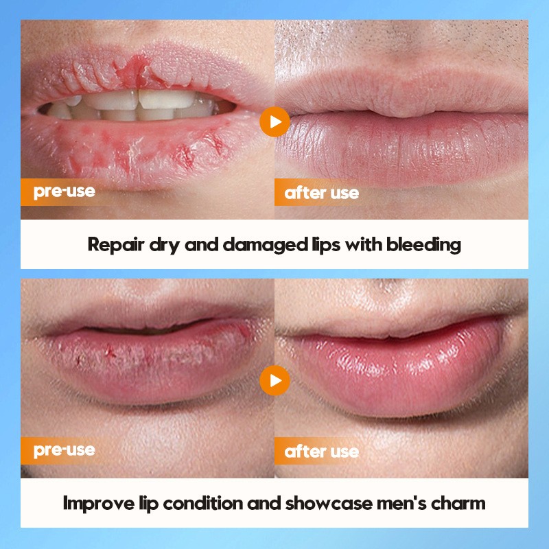 Men's Lip Balm Supplier - Squalane Lipstick Nourish Hydration Anti-dryness Anti Cracking Lip Balm