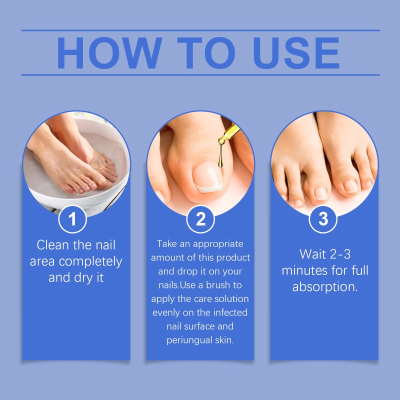 Nail Serum Supplier - Organic Nail Care Solution Nourishing Fungus Treatment Deep Repair Serum