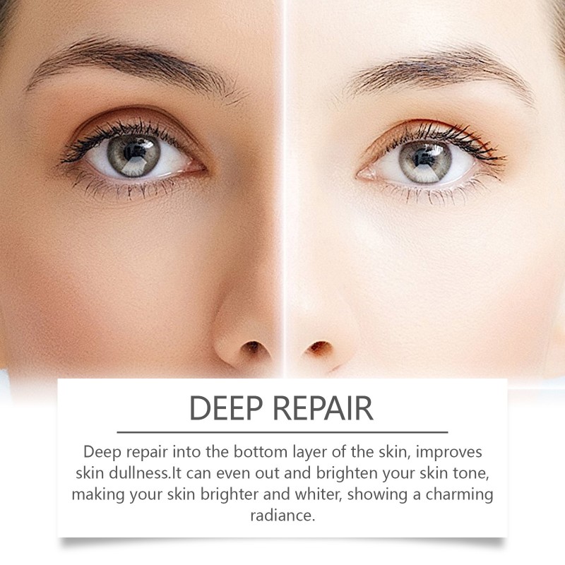 Whitening Oil Supplier - Natural Essential Oil Whitening Nourish Brighten Skin Tone Turmeric Oil