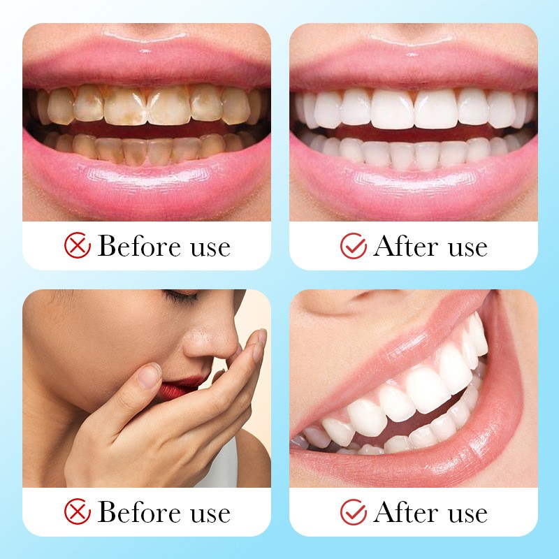 Toothpaste Supplier - Oral Dental Cleaning Stain Removal Brighten Baking Soda Ginger Spearmint Toothpaste
